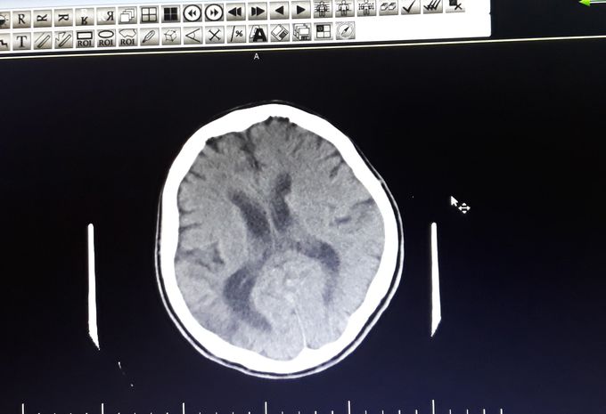What is your diagnosis?