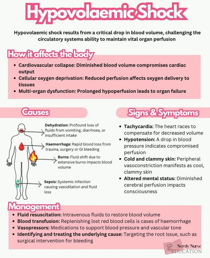 Hypovolemic Shock