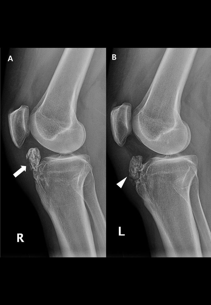 Diagnosis?