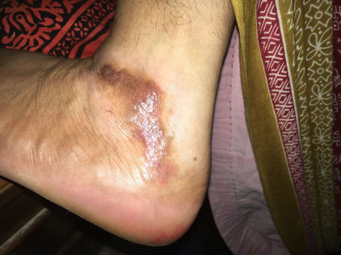 Diagnosis and medication please. Any suggestion?