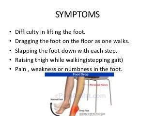 Foot drop symptoms - MEDizzy