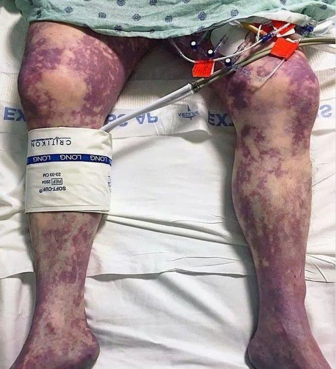 orthopedic surgery