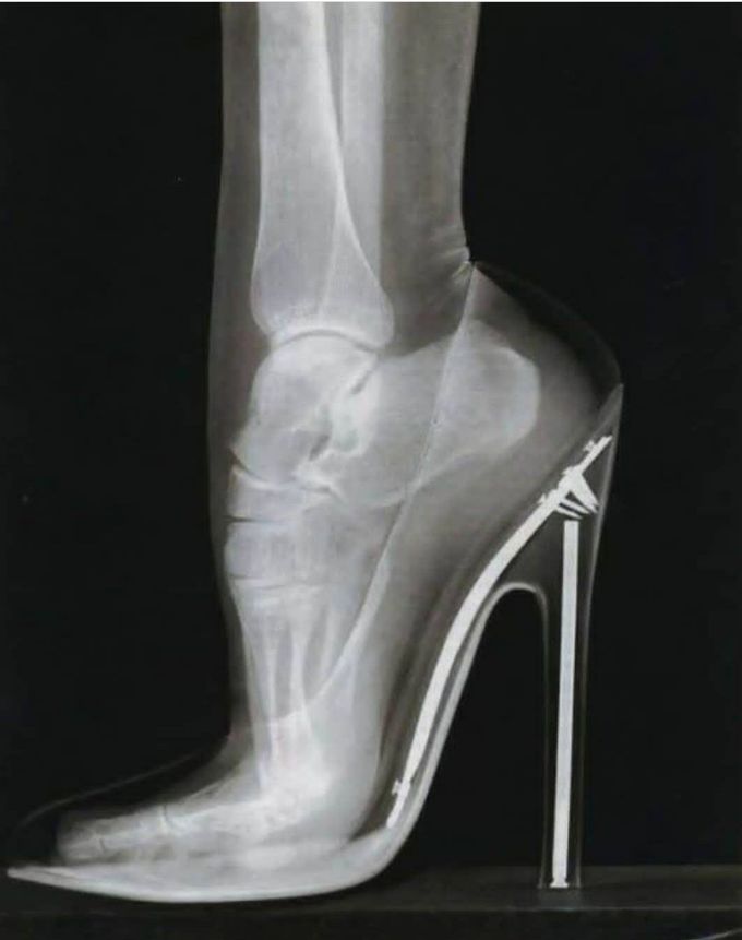 Check a friend  who likes to wear high heels 👠👠👠.