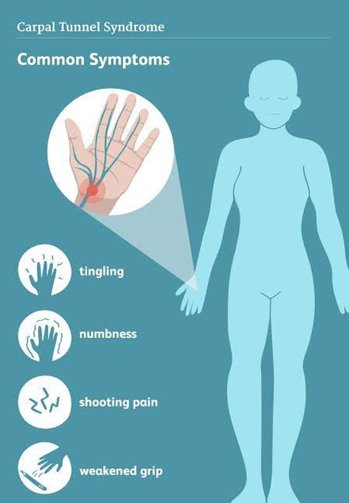 These are the symptoms of Carpal tunnel symdrome