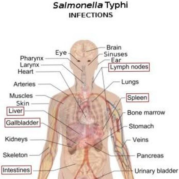 Salmonella bacteria infection in body