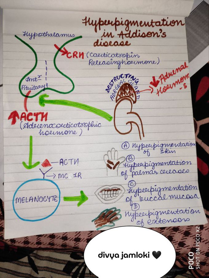 Go and have look on , the reason behind the hyperpigmentation in Addison's disease🖤