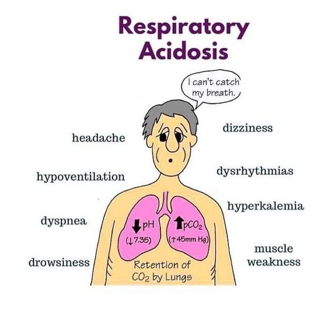 Respiratory Acidosis