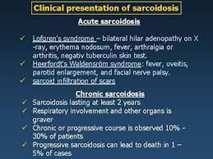 Sarcoidosis- Clinical Presentation