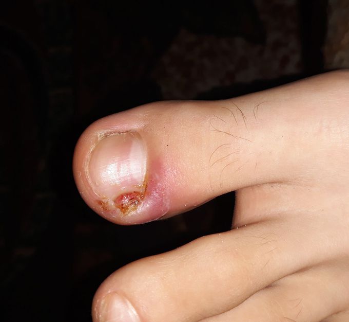 Can you help what's the diagnosis?