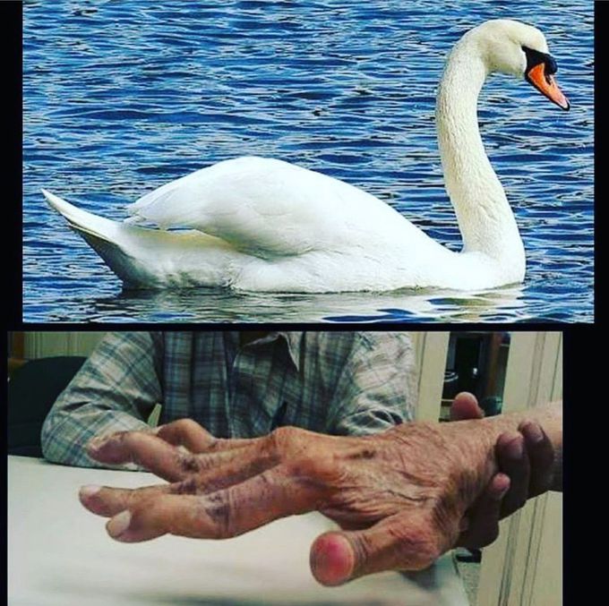 What do you think about this condition?