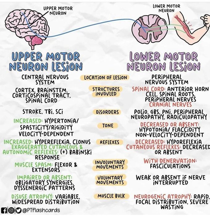 Upper and Lower Motor Neuron Lesions