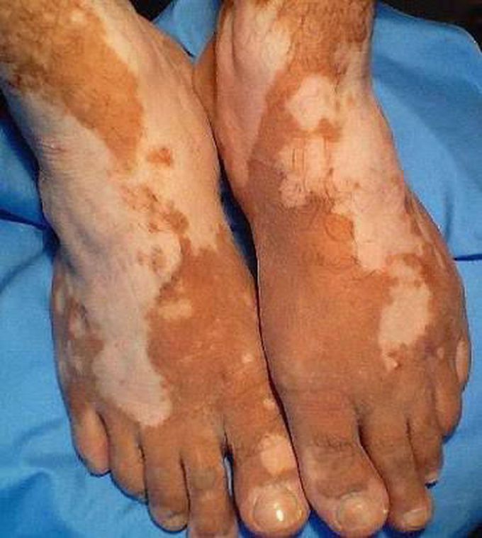 Diagnose??