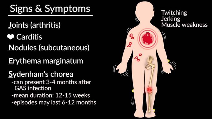 Symptoms of rheumatic fever