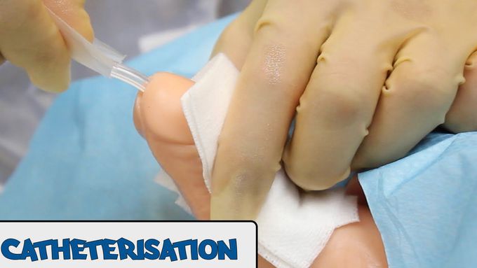 Catheterisation - OSCE Guide