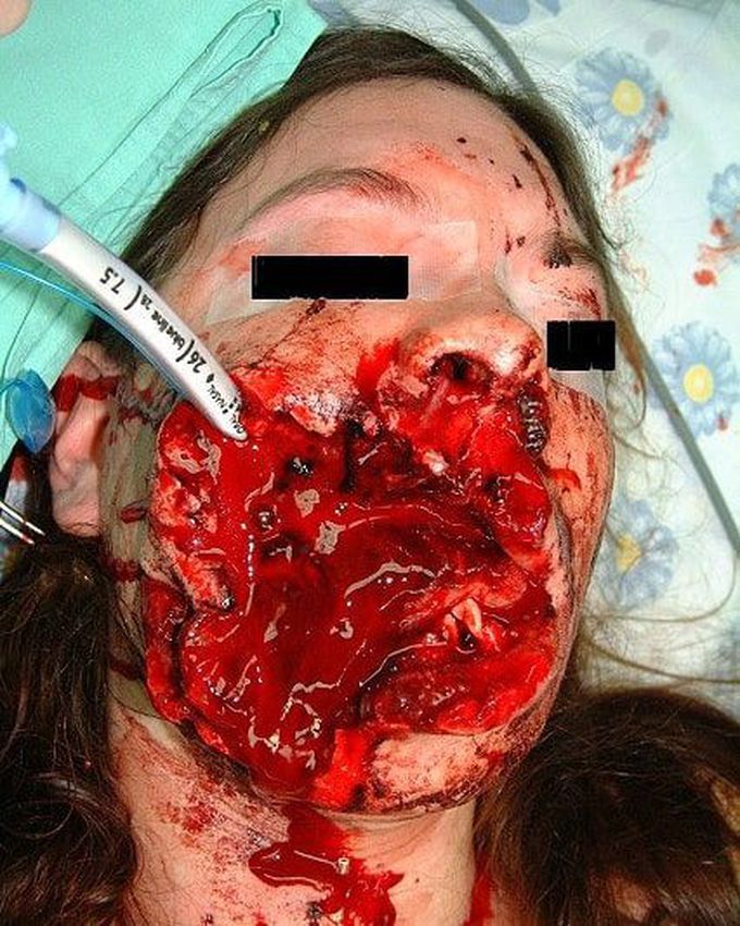 ⚠️ A woman who sustained a single gunshot injury. 