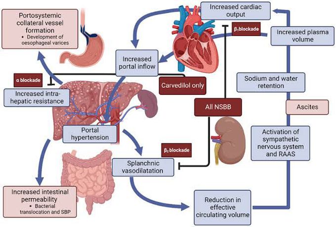 Pathogenesis of Portal Hypertension