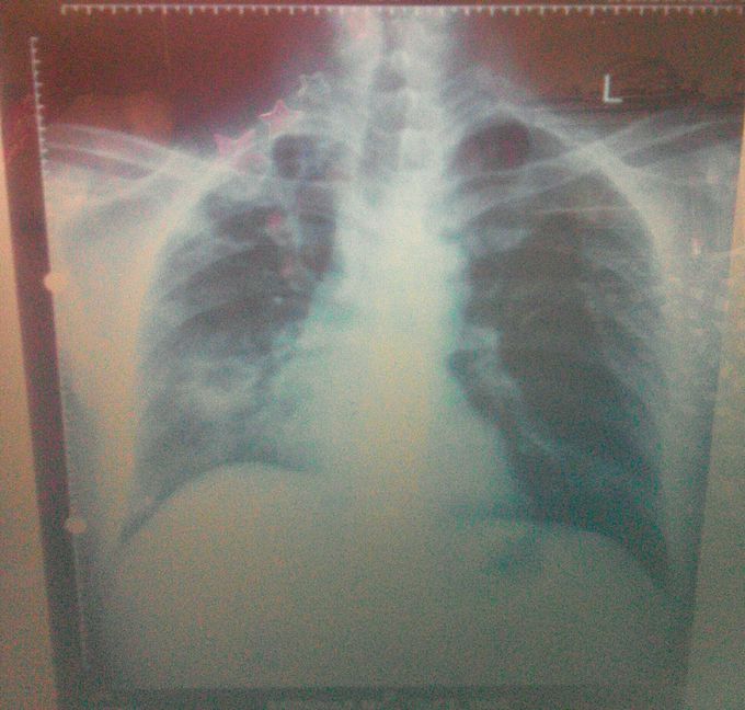 Diagnosis????