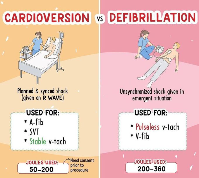 Cardioversion Vs Defibrillation