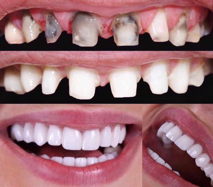 Dental treatment 👄✅👄✅👄✅