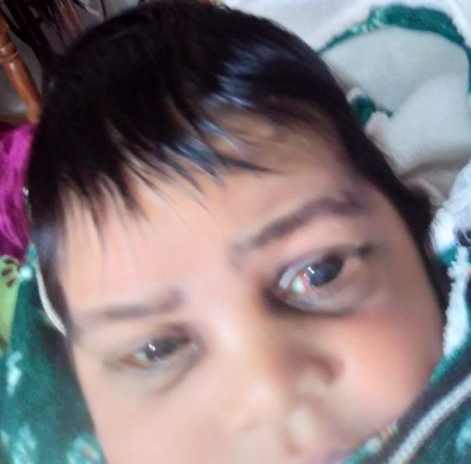 Diagnose #ENT.  NEWBORN eye disorder