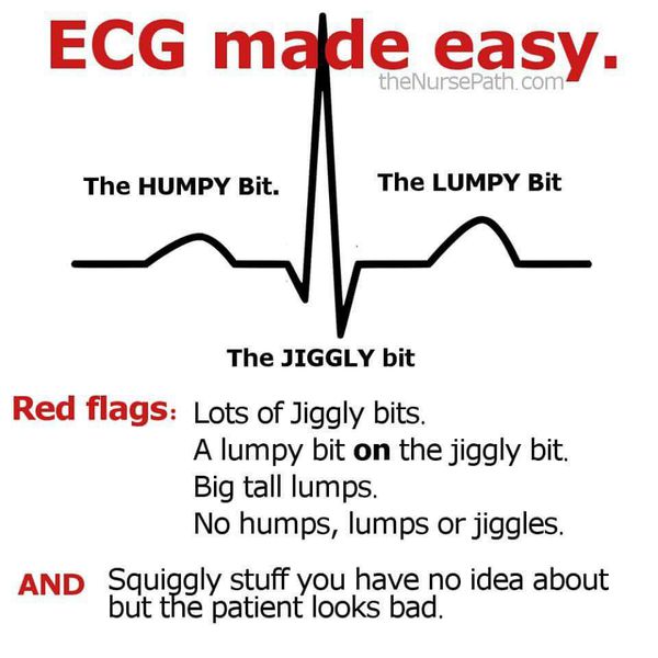 Ecg For Dummies