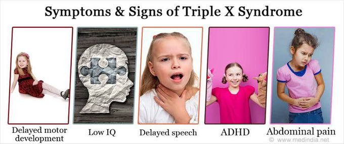 These are the signs and symptoms of Triple X syndrome