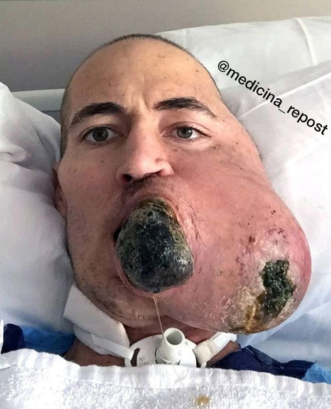 What is the probable diagnosis?