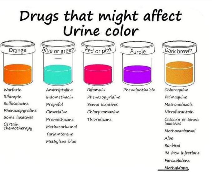 Urine color