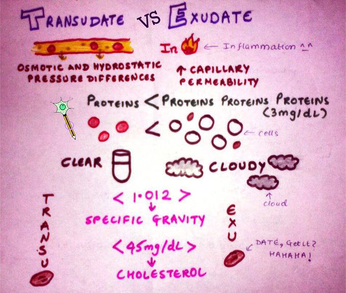 Transudate vs Exudate