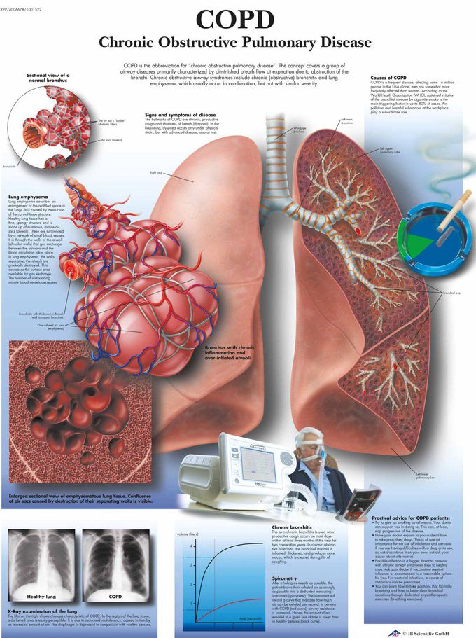 Chronic Obstructive Pulmonary Disease (COPD)
