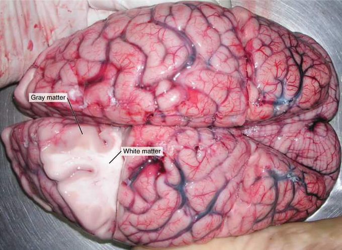 Superior view of BRAIN