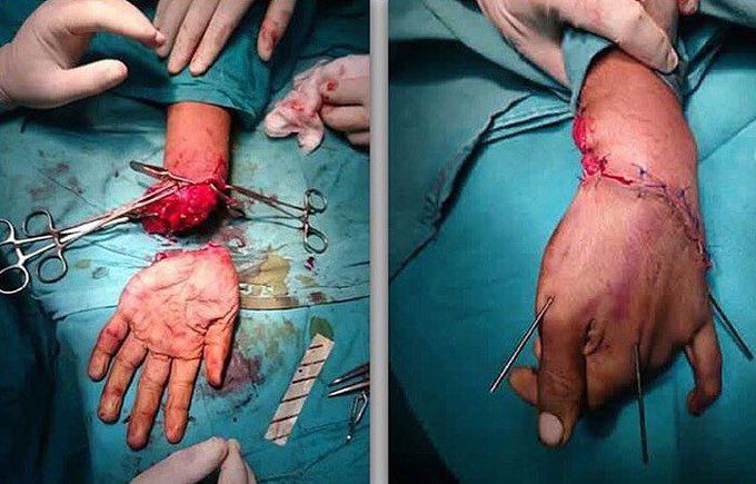 Reconstructive surgery