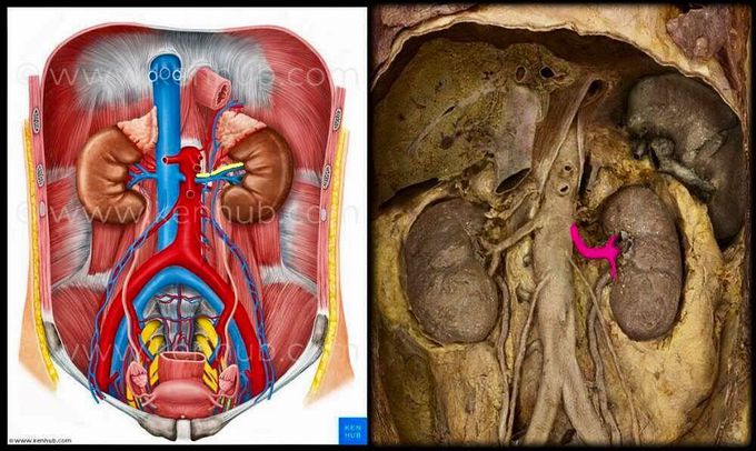 Left renal artery dissection