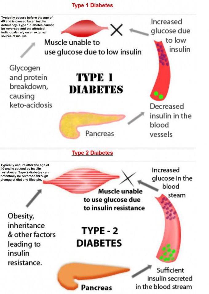 Diabetes And Its Causes - MEDizzy