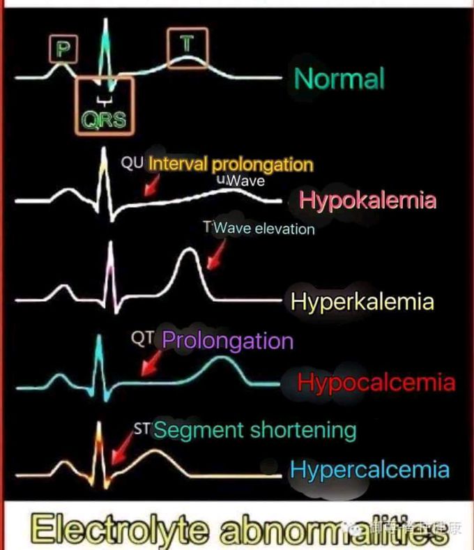 Electrolyte abnormalities