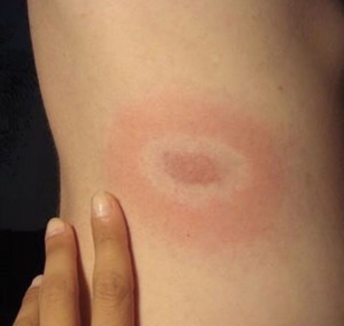 What is the diagnosis ??