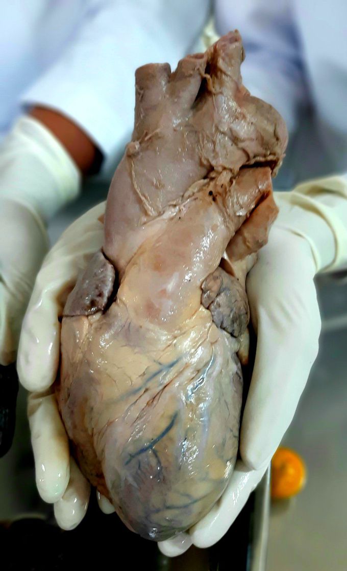 Human Heart