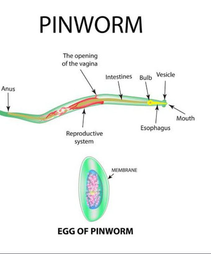 Enterobiasis