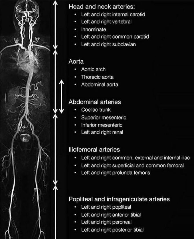 Body blood vessels MRI