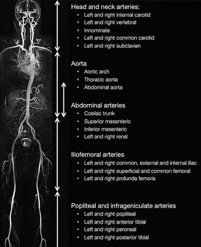 Body blood vessels MRI