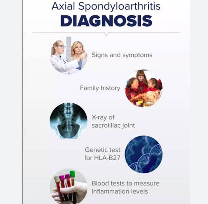 Diagnosis of Ankylosing spondylitis