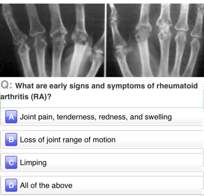 SOMEONE TELL ME THE CORRECT ANSWER ..??