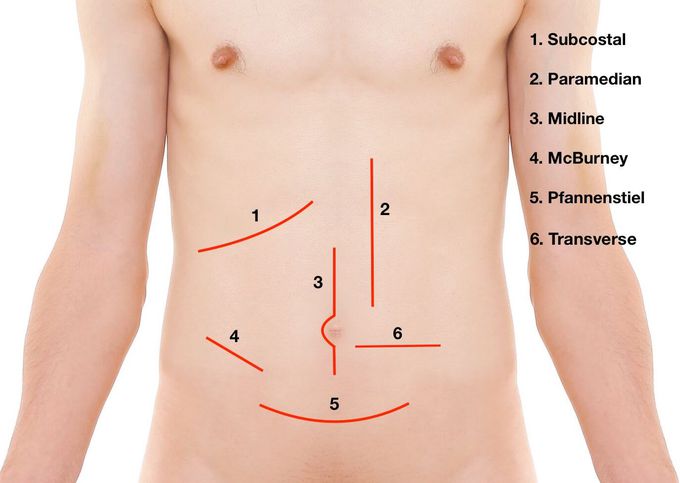 line of Surgery