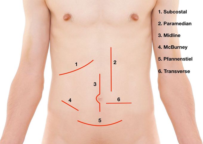 line of Surgery