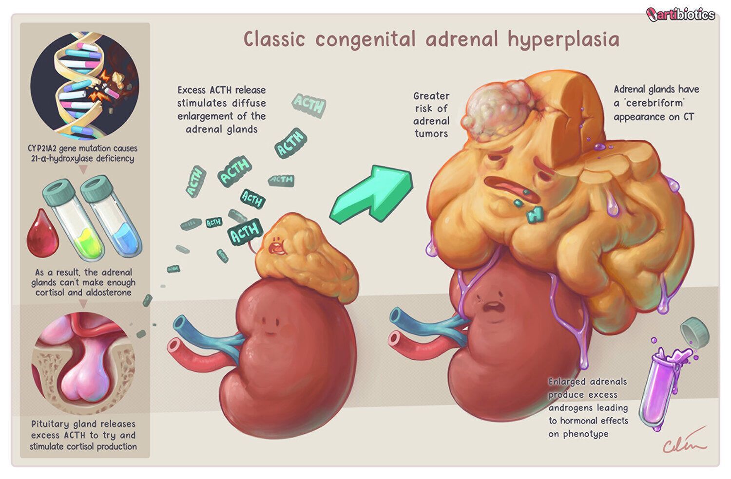 neonatal presentation of congenital adrenal hyperplasia