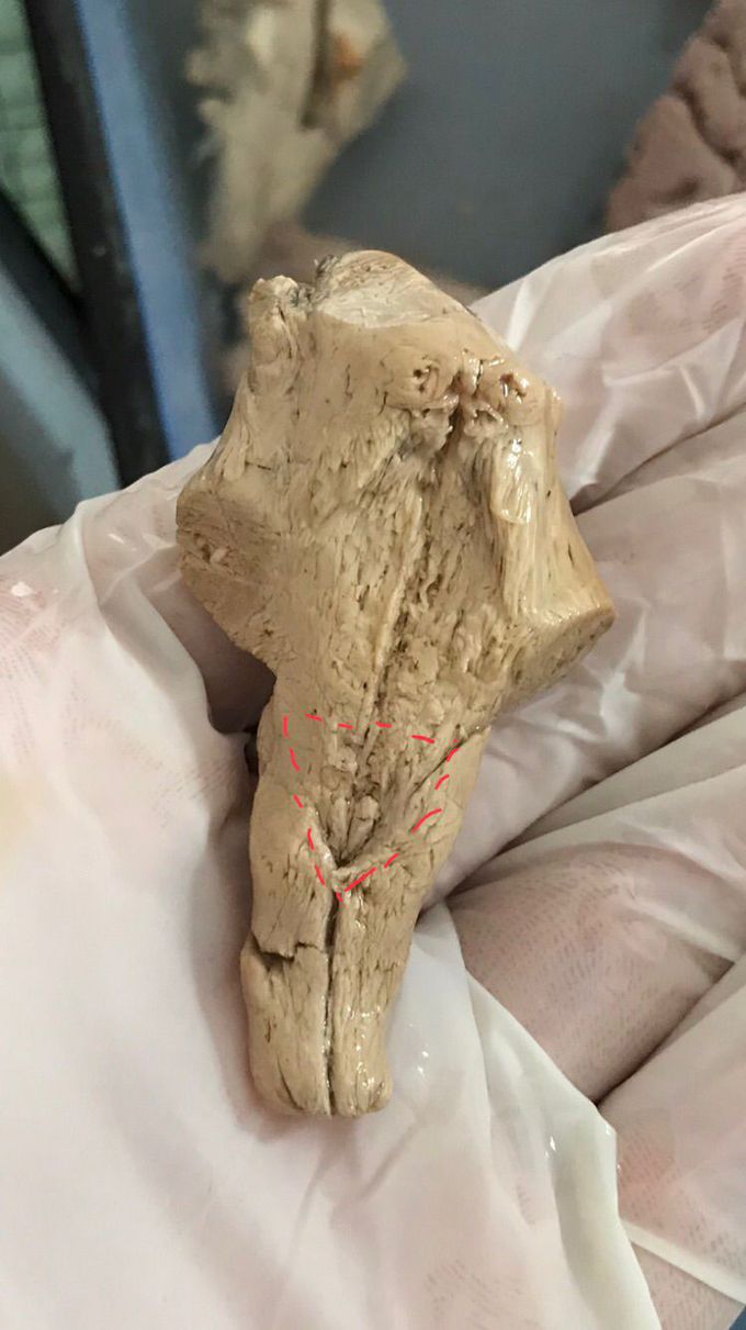 Brainstem: can you name the dotted structure?