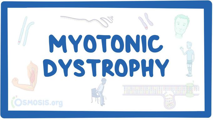 Introduction to Myotonic dystrophy.