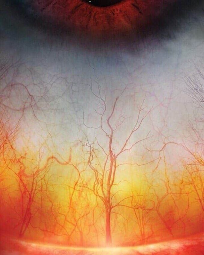 _Fantastic View of the Human Eye under microscope👀
منظر رائع للعين البشرية تحت المجهر.
