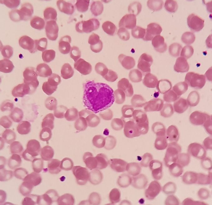 Inlove metamyelocyte💗