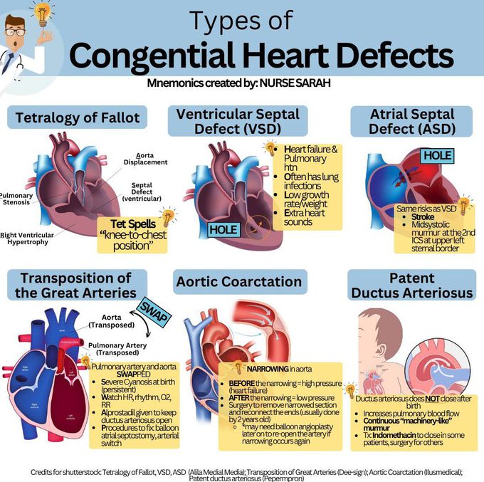 Types of Congenital Heart Defects